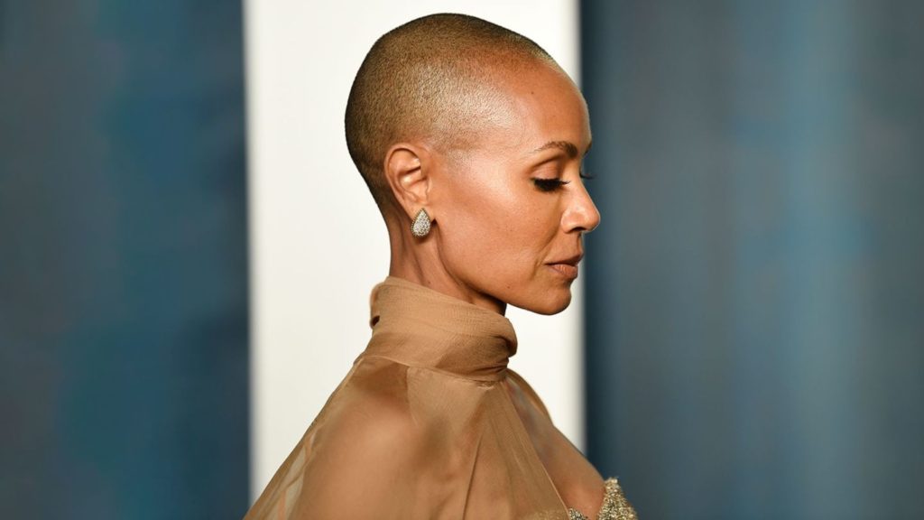 Jada Pinkett Smith Alopecia